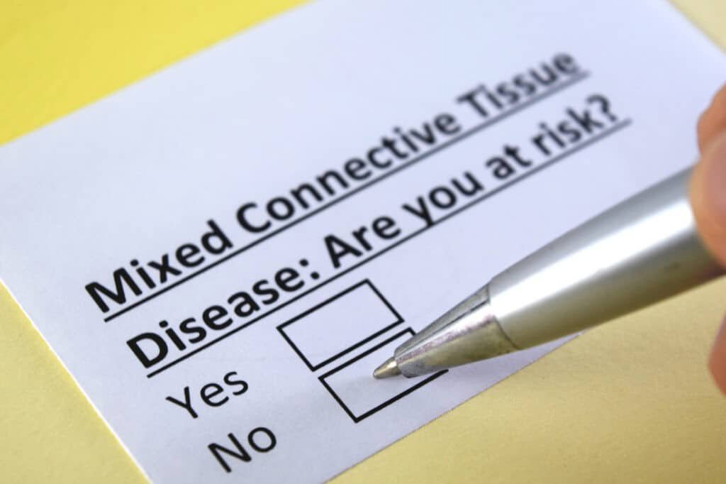 Mixed Connective Tissue Disease (Symptoms and Causes)