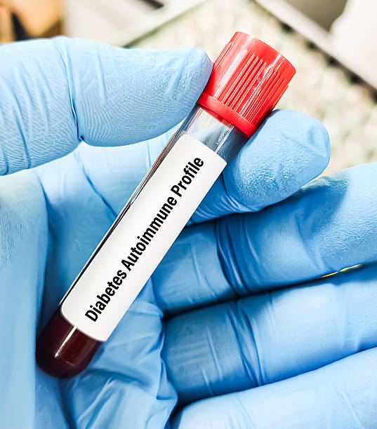 A gloved hand holds a blood sample tube labeled "Diabetes Autoimmune Profile" with a red cap, highlighting the importance of staying grounded while navigating autoimmune life and monitoring overall mental health.